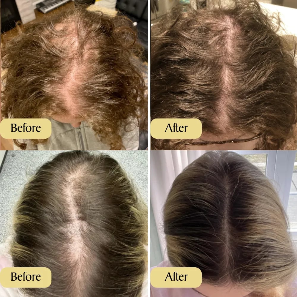 VitalBlossom™ Natural Hair Growth Oil