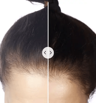 CombyZen™ Electric Hair Rejuvenator