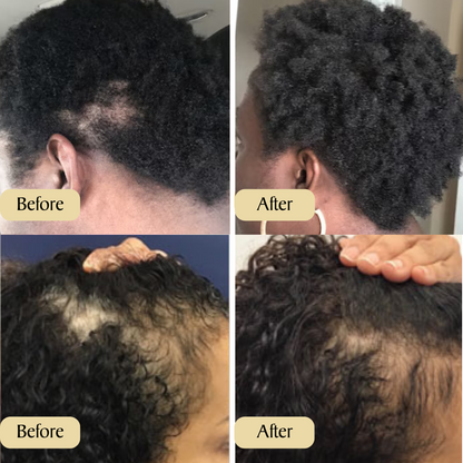 VitalBlossom™ Natural Hair Growth Oil