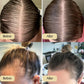 VitalBlossom™ Natural Hair Growth Oil